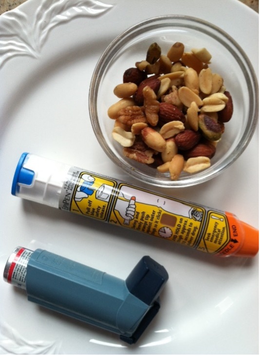 Food Allergies Picture 1